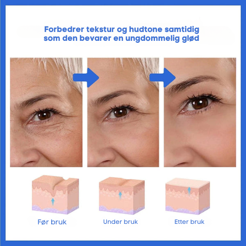 Botox Ansiktsserum by Trendy Mates