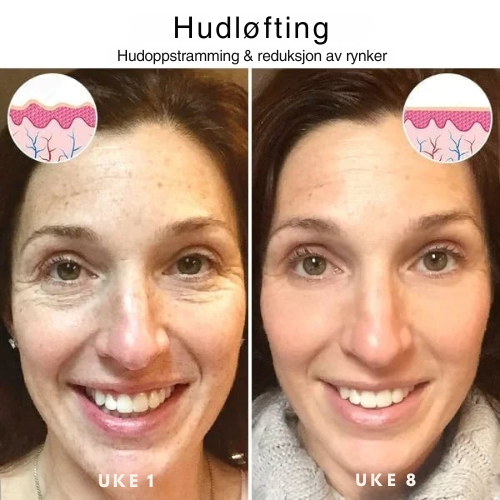 Botox Ansiktsserum by Trendy Mates