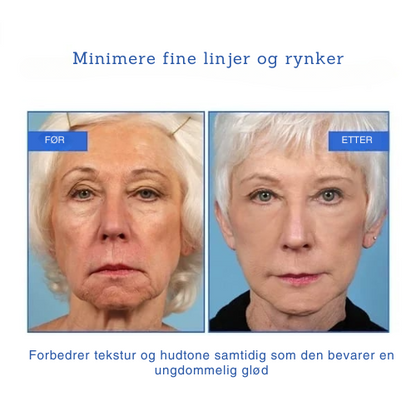 Botox Ansiktsserum by Trendy Mates