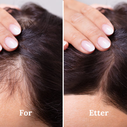 HairGlow™ – Høyfrekvens- og Rødtlysterapi for Sterkere og Fyldigere Hår