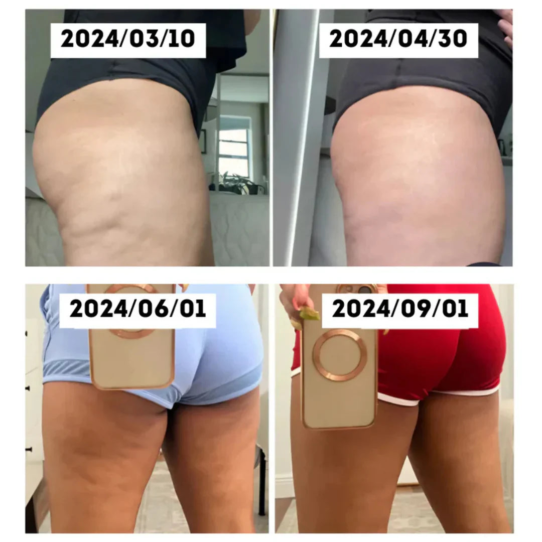CelluGlow™ massasjeapparat