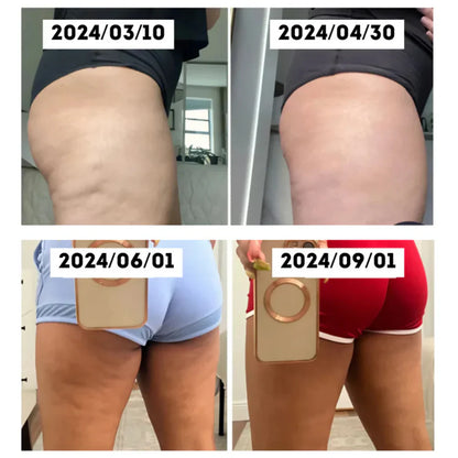 CelluGlow™ massasjeapparat