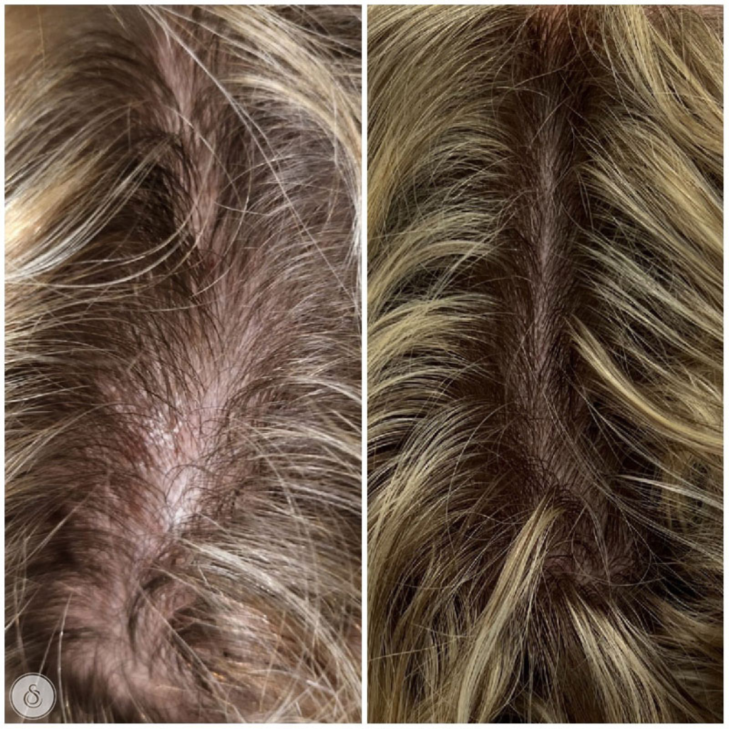 Naturlig grådekning med Nova™ + Gratis Veganic Hår Olje